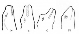 Bridestones Dragonhead profile (Draconis)s - PID:145227