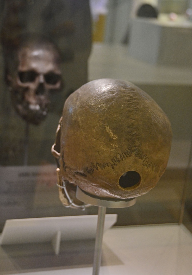 The back of the Clachaig Skull, recorded as part of Canmore ID 39676, museum accession no. GLAHM:A.1912.21/1. The circular hole was where a sample was taken for DNA testing. The skull was found to date to the Neolithic period and is that of a young male,